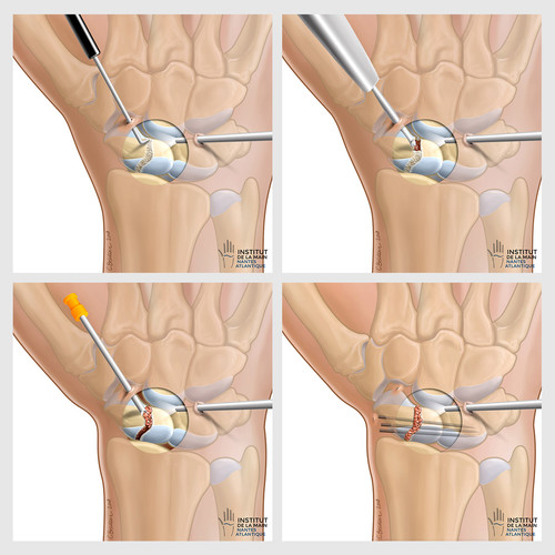 Illustrations de vue chirurgicales