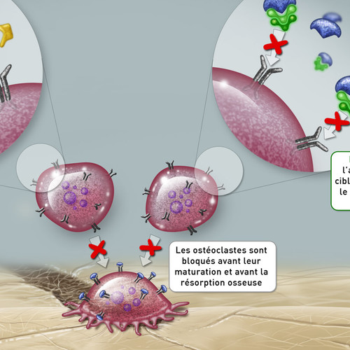 Zoom d'une illustration d'ostéoblaste et ostéogenèse