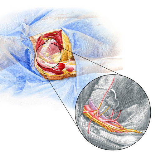 illustration de dissection et zomm de la fosse axillaire