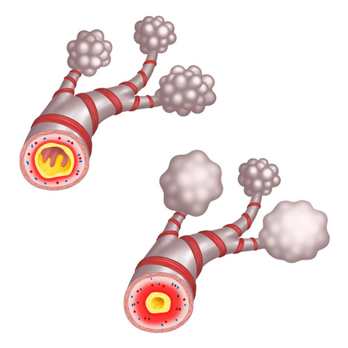 illustration de bronchioles et sacs alvéolaires