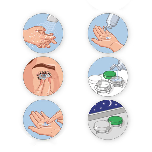 Illustrations didactiques de retrait de lentilles