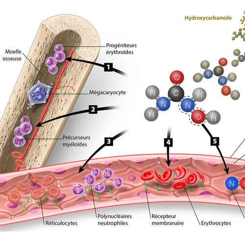 cellules sanguines et drépanocytose