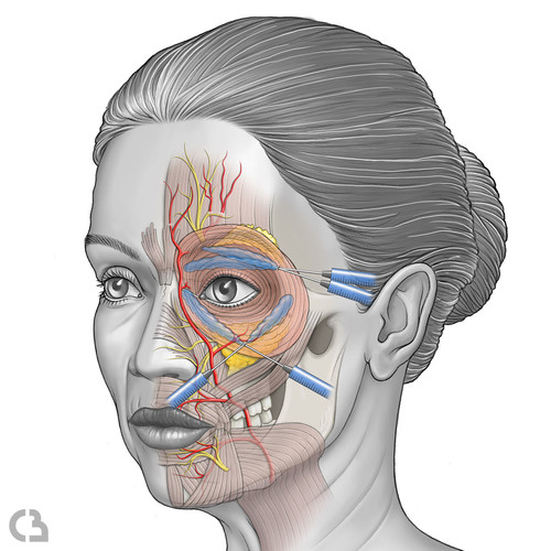 illustration du visage et risque des injections périorbitaires